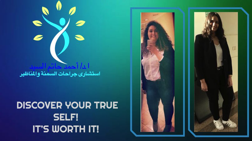 HatemDoctor's tweet photo. #تكميم_المعده https://t.co/bCgnx9X624