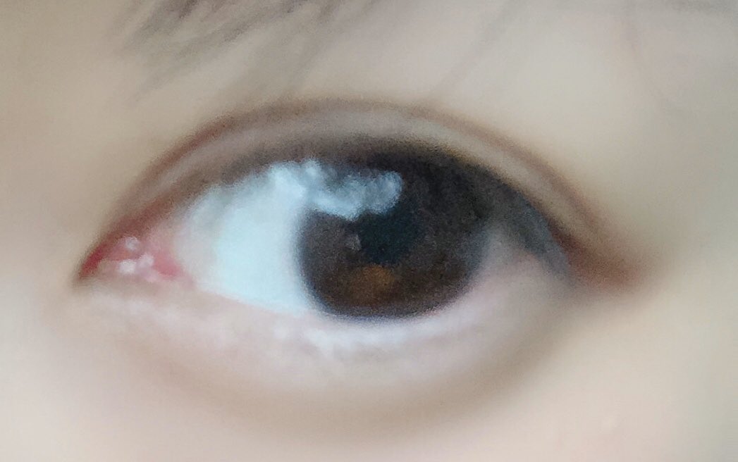 つづ 埋没経過 Tzflowertz Twitter