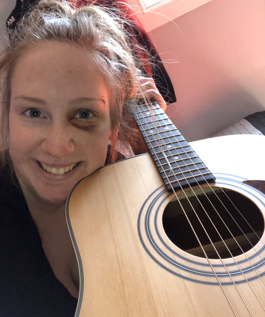 Kenziecurling's tweet photo. Early birthday present from my parents😍 🎸 my poor neighbours might need some earplugs right now😂 #ExcuseTheBlackEye 🤦🏼‍♀️ https://t.co/PMsK5rj1za
