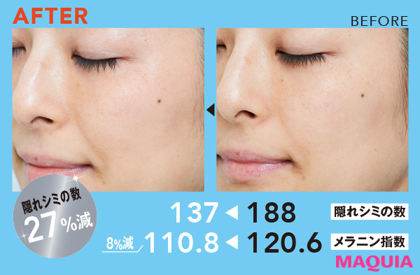 マキア編集部 今あるシミを 無色化 するってホント One By Koseの美白美容液の実力をチェック 30日間お試しの結果やいかに 詳しくはこちら T Co Nj15xbes スキンケア 美白ケア おうち美容 ワンバイ コーセー 美白グランプリ