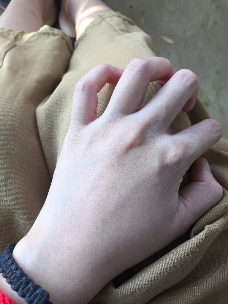 n_nxnyxx's tweet photo. ลูกชาวนาก็ขาวได้นะจ้ะ ไม่ใช่คนขาวผิวจะออกเหลืองๆซีดๆหน่อย บวกกับมีความรักก็เลยหันมาดูแลตัวเอง หมดไปเยอะ อยากมีผิวสวยแต่ไม่บำรุงไม่ดูแลชาติหน้าก็ไม่มีผิวดีหรอก กินน้ำเยอะๆช่วยได้จริงๆขัดผิว ใส่เสื้อแขนยาวกางเกงขายาวอบไว้ ขาวจริงค่ะลองดู   #ฉันจะขาว #HowtoPerfect https://t.co/2wDcS3Wriz
