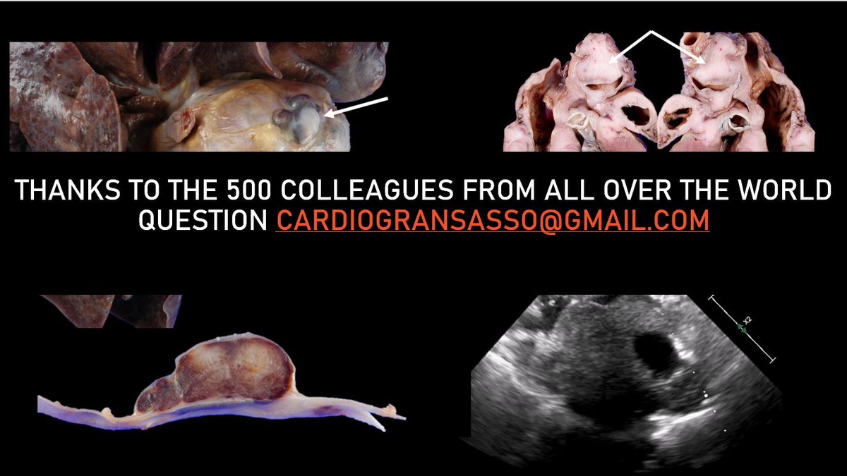 Grazie ai 500 colleghi da tutto il Mondo che ci hanno seguiti in questa prima sessione di webinar dedicati alla cardiologia veterinaria. Continueremo a tenervi informati sulle prossime lezioni attraverso la mail e le nostre pagine social. #veterinarycardiology #veterinarymedicine