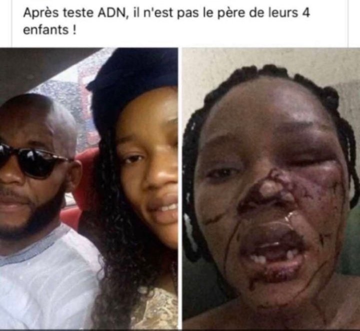 tansuukee's tweet photo. @chroniquetwitt1 Les filles qui valident ce qu'a fait la petasse à son mari vous validez ça aussi ? https://t.co/CGPKThBN2X