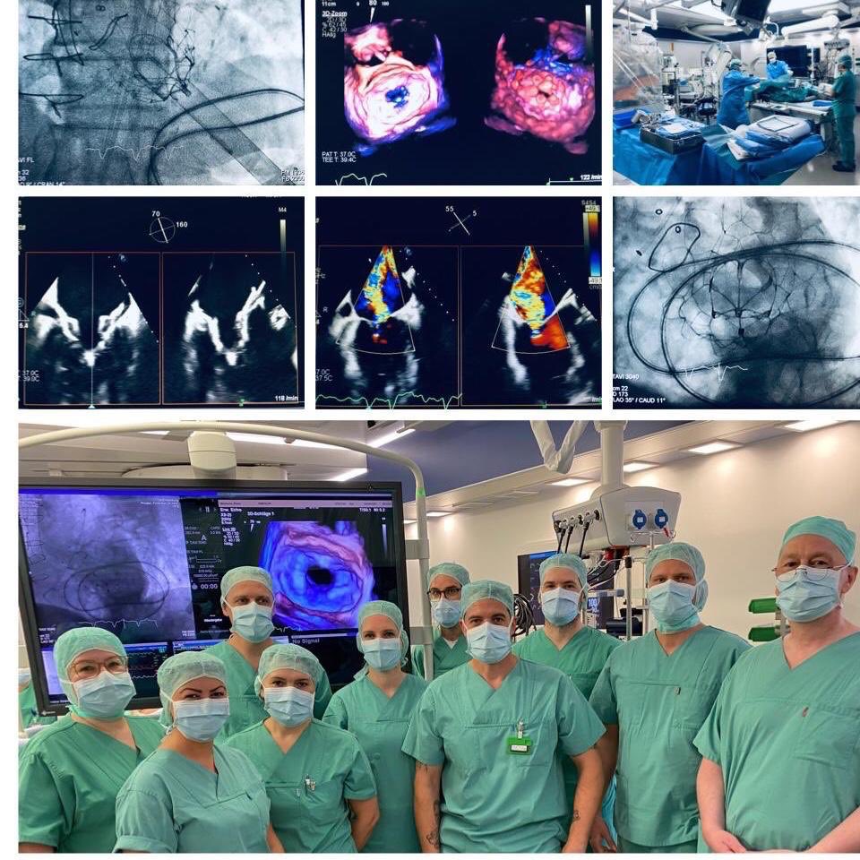 Lenard08808061's tweet photo. World‘s first 2 commercial Tendyne TMVI cases at UHC Hamburg! Great success! It‘s all about the TEAM! @TCTMD @PCRonline @TMVRbot https://t.co/v4sh9K6uAA