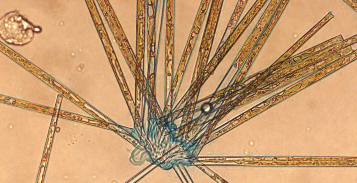 Publi_MNHN's tweet photo. ▪️ Morphological description and molecular phylogeny of two diatom clones from the genus Ulnaria (Kützing) Compère isolated from...

https://t.co/79TFIiASMX
Yulia R. ZAKHAROVA et al.
#Cryptogamie #algology #algologist #algae #diatom  #diatomist #phylogeny https://t.co/8dIRmEqI7E