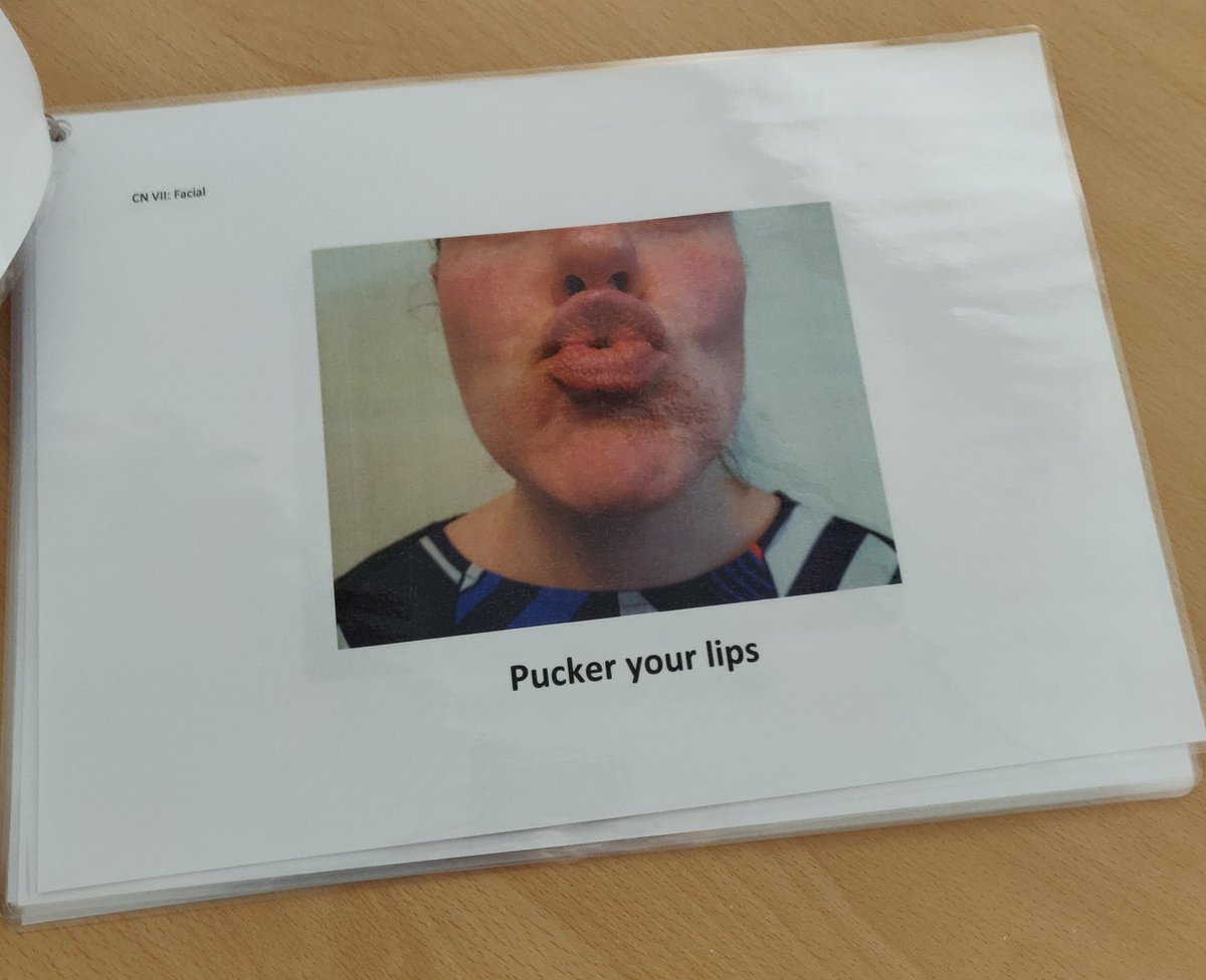 SLTGabby's tweet photo. Me and my colleagues have found it difficult to complete oromotor/cranial nerve exams with surgical masks on, as it takes away the ability to model the instructions we give to patients. So we decided to make a new (cleanable) visual - with yours truly as a the model! #mysltday https://t.co/IbVQj3VlN8