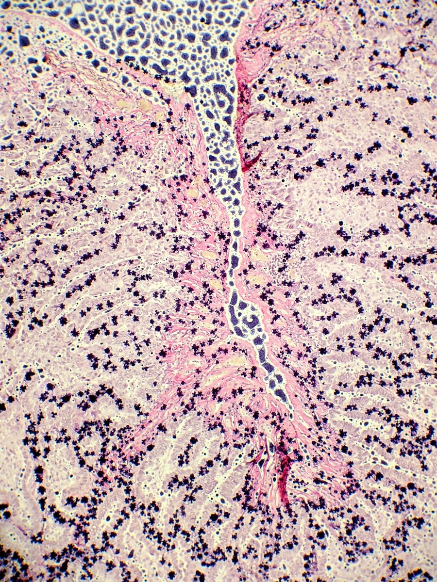 sarah_glogowski's tweet photo. Apparently our new elastin kit is being difficult... At least it gave me something interesting to look at. #pathArt #pathology #bumcpath https://t.co/jJM9ISibpO