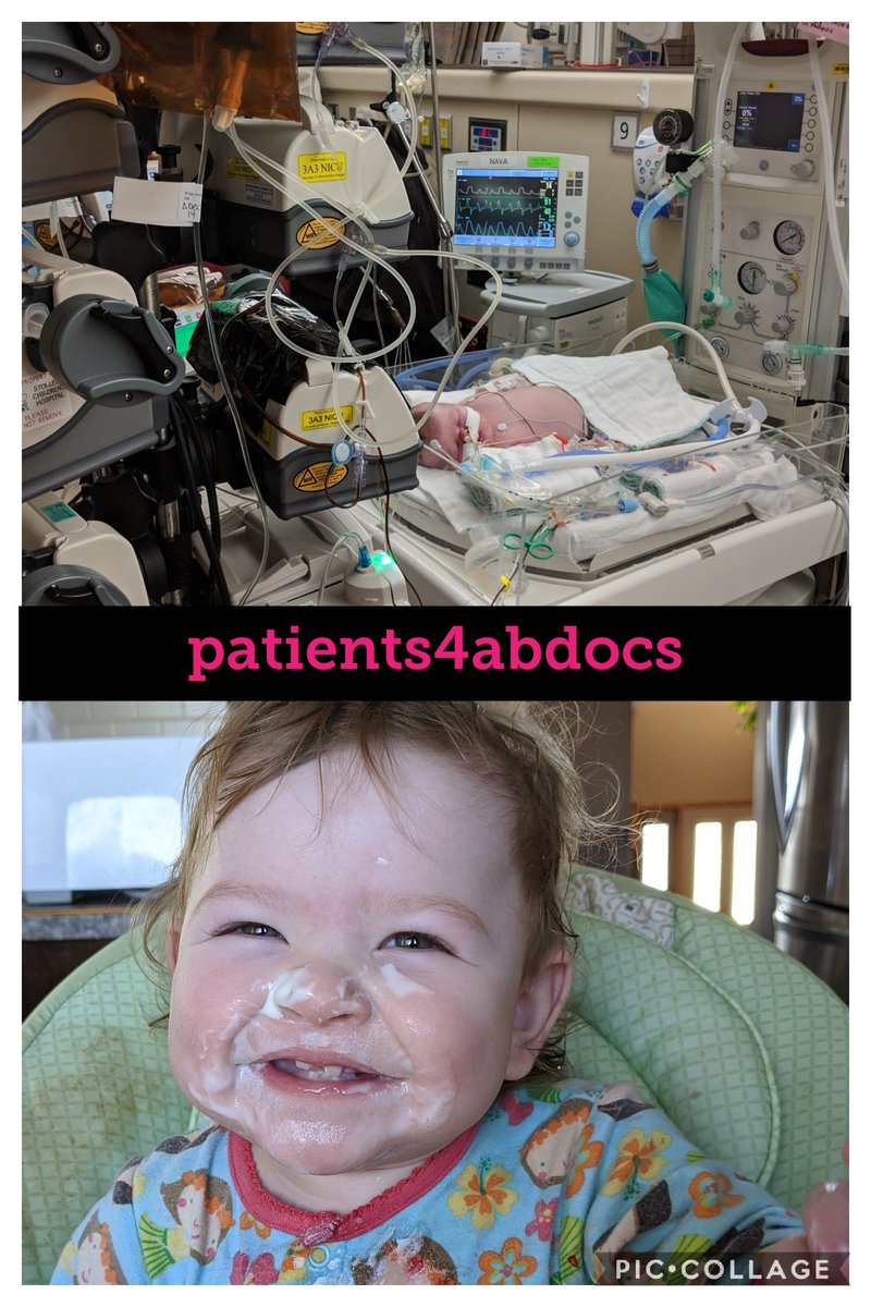 MatchStik84's tweet image. This is Eowyn, shortly after she experienced a stroke around 4 weeks old, and now at nearly 18 months. @jkenney @shandro Cuts to healthcare would deny her easy access to the countless appointments she continues to need. Please work with @Albertadoctors #patients4abdocs