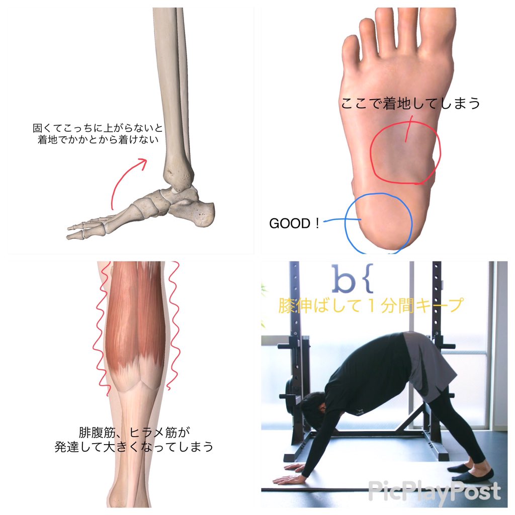 鈴木孝佳 姿勢改善の専門家 足首固いとさらに不幸の連鎖で太ももも恐ろしく発達します 足首固い かかと外側すぎる接地 膝が安定しない 膝ブレ止めるため前と外モモ力入る モモがバリバリに張る 発達 靴のかかとの外側がかなり減ってる