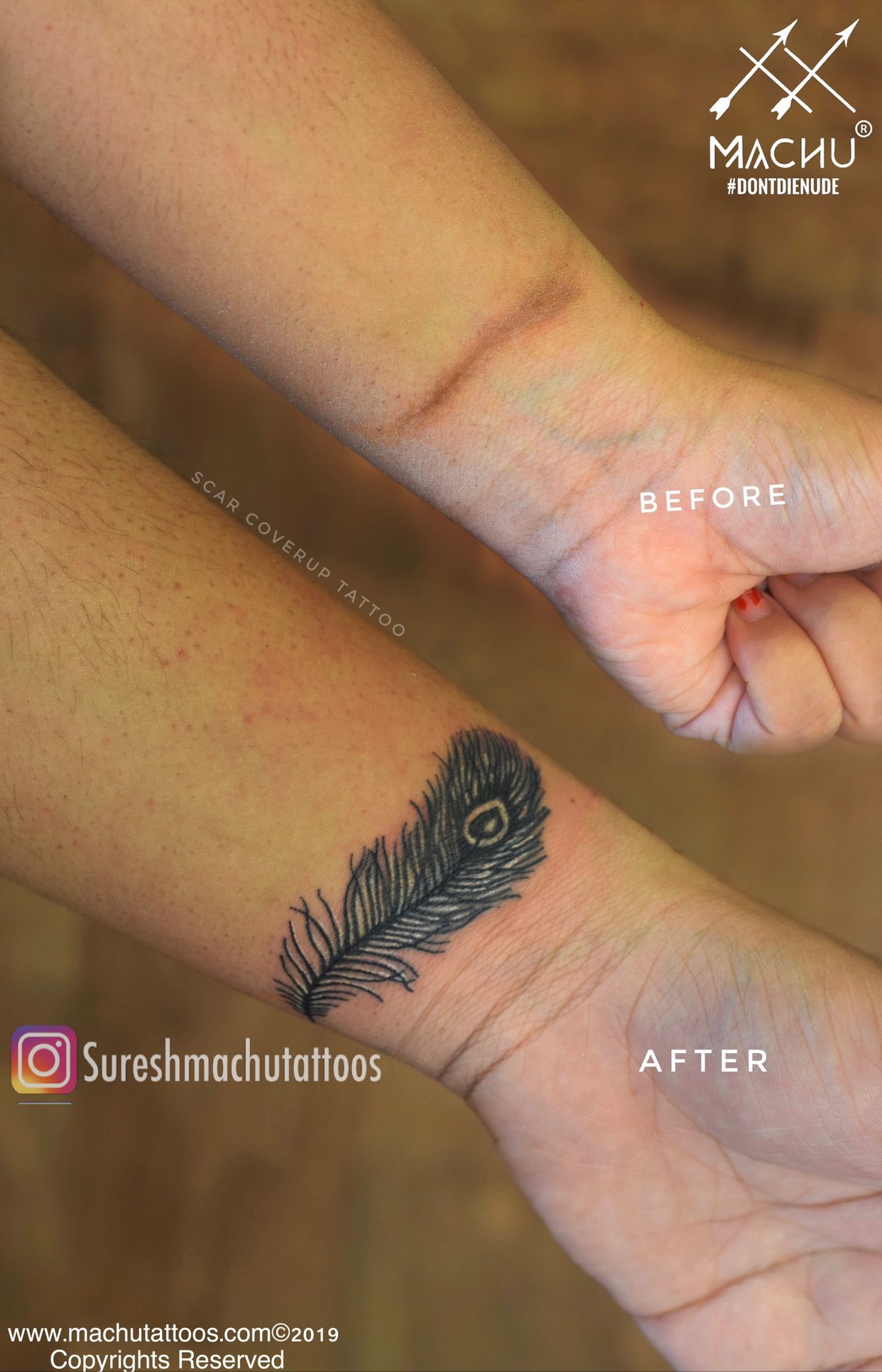 Scar “less is more” tattoo ideas? : r/tattooadvice