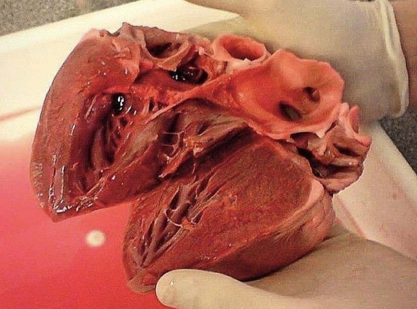 anatomiae_'s tweet image. Quando alguém fala que está com o coração partido eu só consigo pensar nessa imagem: