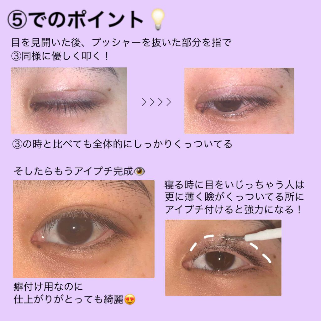 Lips リップス 今回は 元ほぼ一重の奥二重だった私が コロナ休みで二重になった癖付方法を紹介します 使うのはアイプチだけ 不器用さんも1アイテム使えば簡単なので みんなで二重を手に入れちゃおう T Co Ub4zgokpkq ダサいたまちゃん