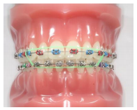 Have you seen our new fact sheet on elastics and what you should do whilst you cannot see your orthodontist? bit.ly/3axmiS8 #orthodontics #braces
