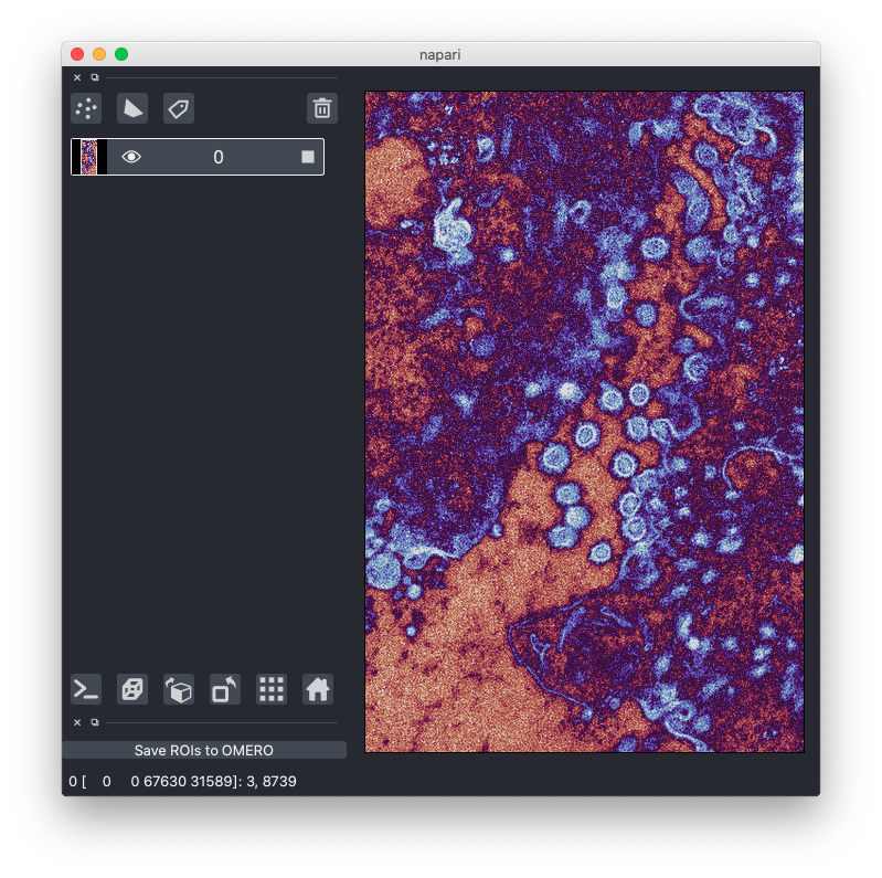 30GB 🔬 image of #covid19 newly published to @IDRNews converted to <a href="/zarr_dev/">zarr_dev</a> stored in <a href="/emblebi/">EMBL-EBI</a>'s Embassy S3 and viewed with an <a href="/openmicroscopy/">openmicroscopy</a> plugin for <a href="/napari_imaging/">napari</a> -- #opendata #openscience #opensource ❤️ dundee.ac.uk/stories/covid-…