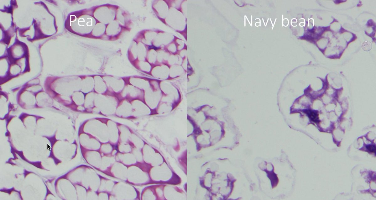 DrGeeONE's tweet photo. Experiment involving processing of food particles to see how they look under the microscope. This helps in recognizing foreign particles in tissue.
Well, I once passed melon seeds for processing too.
😀😛
#CAPVirtualPath #FoodPath https://t.co/Ln7G7nSMsA