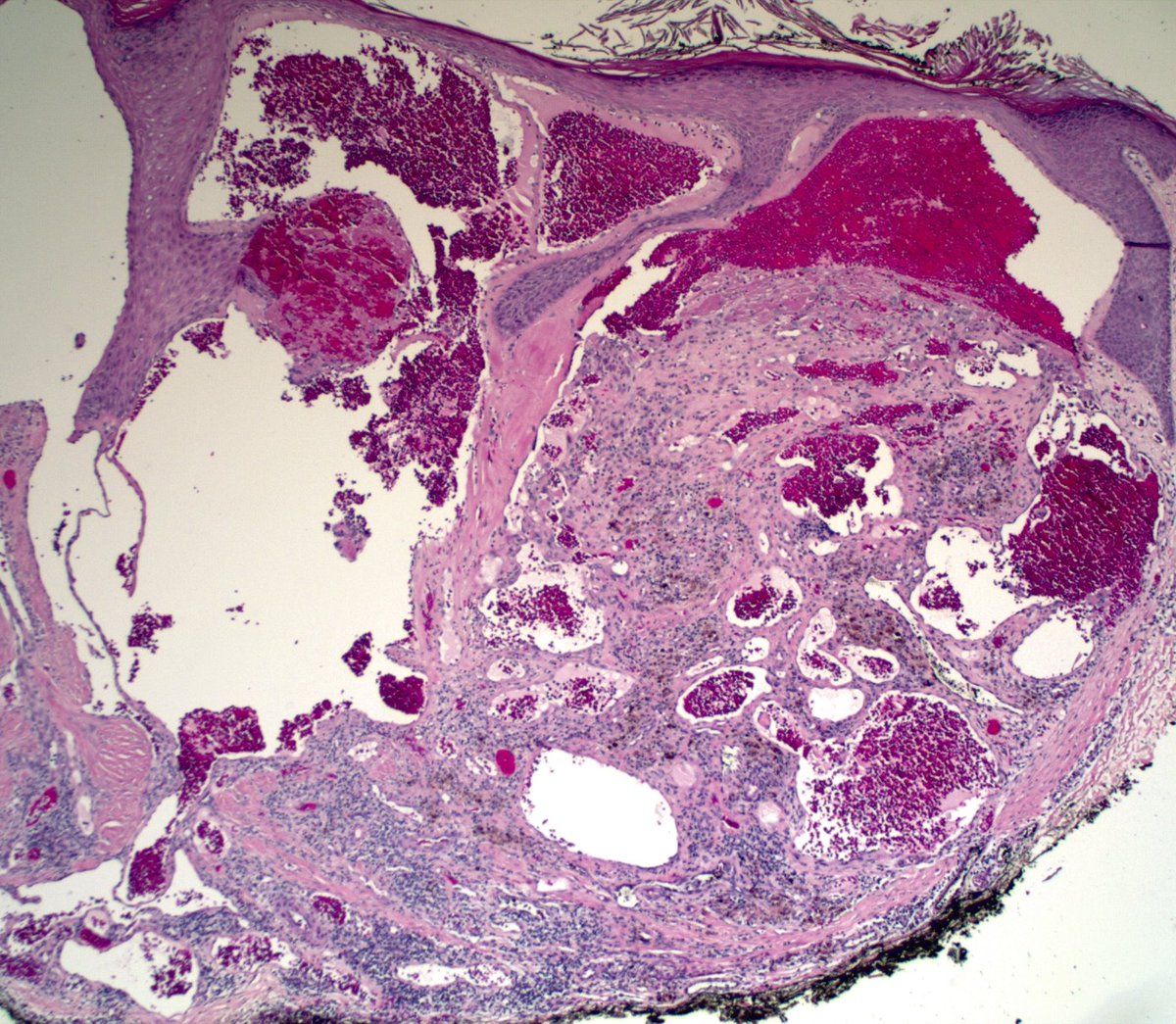 Ryan Hick, MD tweet media