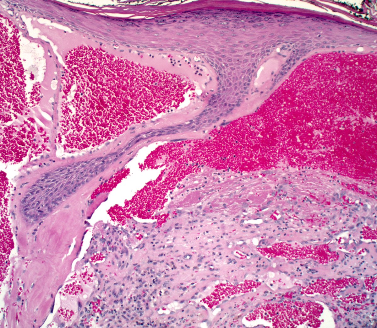 Ryan Hick, MD tweet media