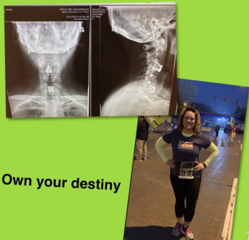 Annuity_girl's tweet photo. My Friday Finish line moment: 2019 I did the 5k 19 weeks after having my second cervical spine surgery. Walk, run, crawl just SHOW UP!
I will be walking the #indymini #donatelife #whyimini #walkkngforhealth #acdfwarrior #orthoindyathlete #indyminiamb #walkindy #inthistogether https://t.co/CyyzMK18Zi