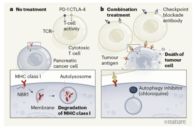 NatureCancer's tweet photo. More #WeekendReads #NatureCancerPicks
"Autophagy promotes immune evasion of pancreatic cancer by degrading MHC-I" very nice work from @KeisukeYamamo12 @AlecKimmelman @rushika_perera @nature with a News&Views from @Aiims1742
https://t.co/SL1eik8BJa
https://t.co/SnDycaBqpL https://t.co/NRQiMtExAI