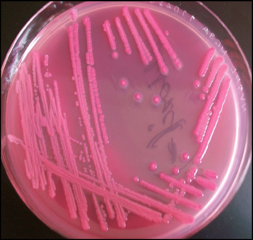 TalahAlmadi's tweet photo. #CLS439
A pt. came to the clinic suffering from urinary tract infection, A sample has been taken from her to do a bacterial culture, the colonies morphology came as:
- name the bacteria caused the infection.
- name the type of (media) agar used and why it +ve result. https://t.co/786w7nKqJ2