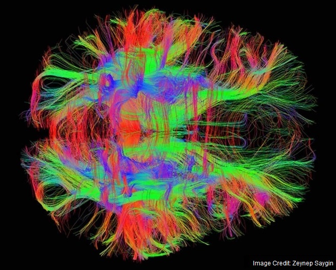 Reminiscent of patterns in Indra's net, Diffusion Tensor Imaging uses magnetic resonance to track the flow of water in tissue. Providing maps of neural pathways, it measures brain network connectivity among white matter microstructures and axon tracts.