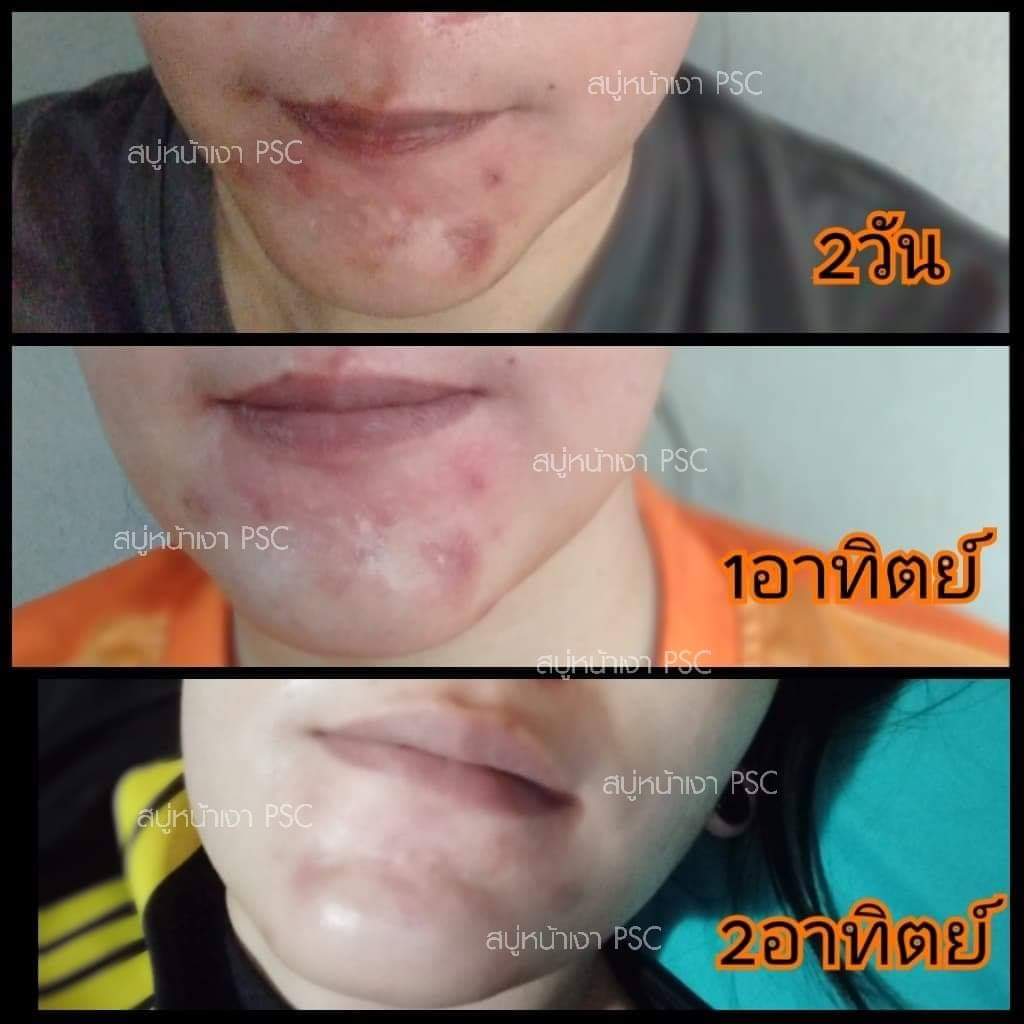 by_psc's tweet photo. ดีกว่านี้มีอีกมั้ย❤ https://t.co/pyS7cKcQIP