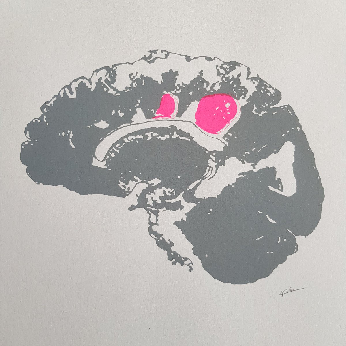 charcotstudio's tweet photo. My fave week of the year...it's MS Awareness Week! 🧠💕 #ThisisMS #MSWeek #MSawareness #charcotstudio #makingMSvisible #redesigning #MRIscans #screenprint #spotthelesions #stopMS
https://t.co/E3WjmMab5l https://t.co/hH2oxA58uJ