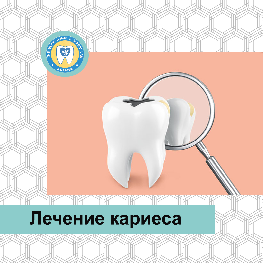 TheBestClinicML's tweet photo. Лечение кариеса в нашей клиники осуществляется исключительно высококвалифицированными врачами-стоматологами. Доктор проведет консультацию для всех желающих, ответит на интересующие вопросы и поможет определиться с оптимальной тактикой лечения в зависимости от имеющейся ситуации. https://t.co/cqnSbrh75u