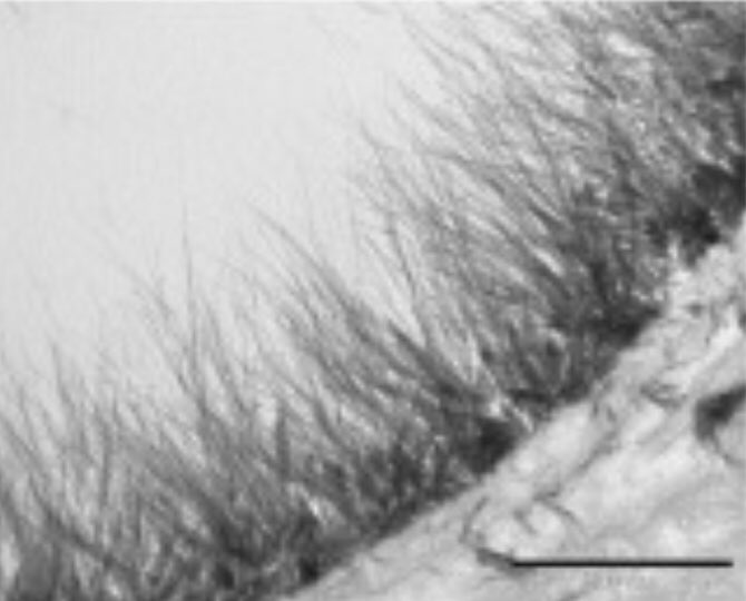 #COVIDー19 a sebep olan virüsün vücuda damarlar yolu ike yayılıp tüm endotel dokuyu hedef aldığı ortaya çıktı. 
Tabiki yüzbinlerce yıldır karşılaştığı sayısız virüs ve bakteri ile savaşından galip çıkarak evrimleşen vücudumuzun bu durum karşısında bir savunması var: 

GLYCOCALIX