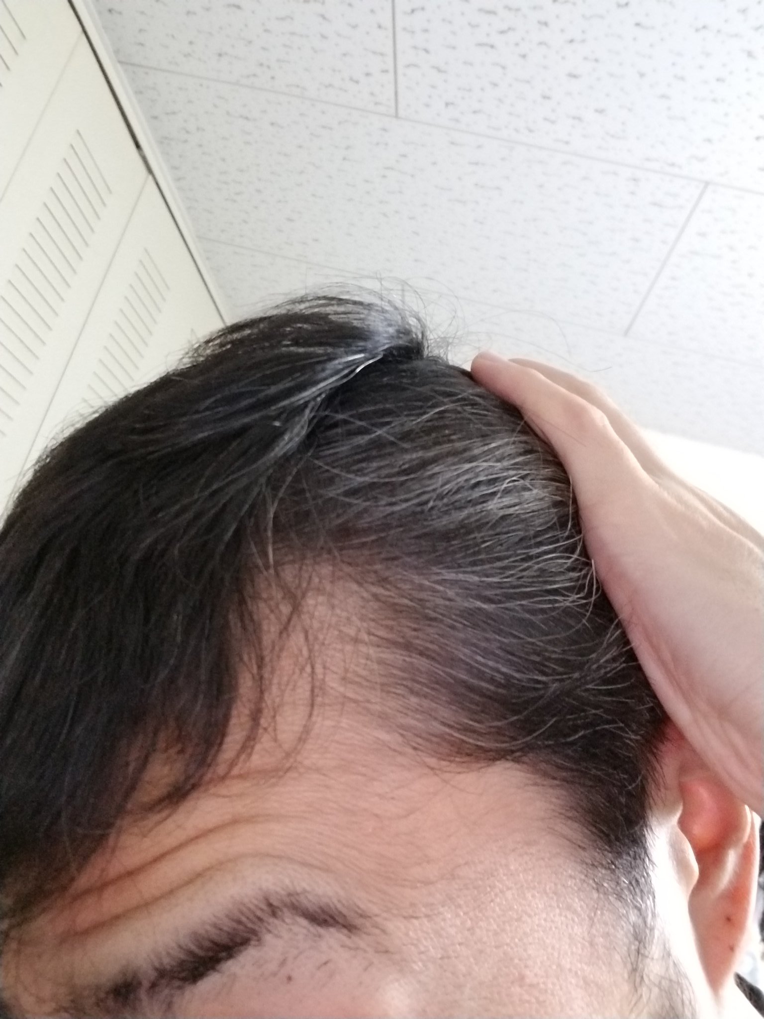 服部整治 体は正直なんだな って夜以外使った事なかったんですけど 朝起きたらサイドの髪がほとんど真っ白になってました やっぱストレスってあんのかなー 気にしたことないけん ともあれ白髪染めしたら完全に一致したのでデコの広さは置いといて張っ