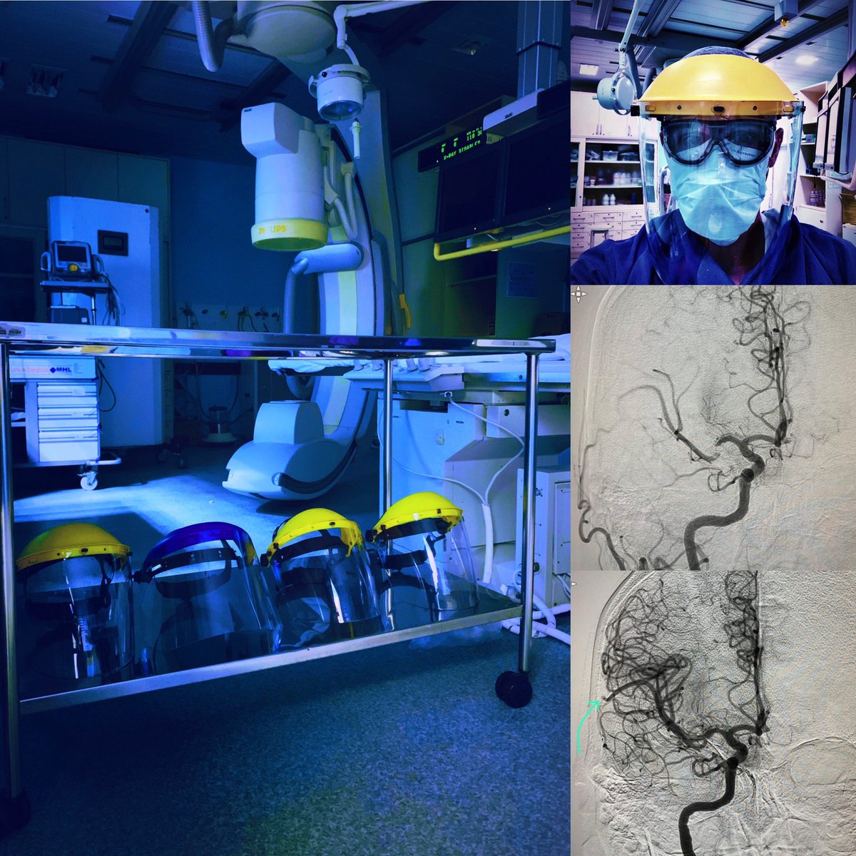 Neurorradio's tweet photo. Readiness for thrombectomy in a COVID-19 mood... @ABAVC_Oficial @RBAVC #StrokeChat #LeaveNoELVOBehind https://t.co/hKOiT55hFB