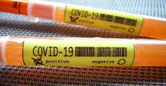 FTWChamber's tweet photo. As of last Wednesday, @JPS_Health is now processing its COVID-19 tests, which will help reduce the time for results from several days to about an hour.
#fortworth #jpshealth #fortworthnews #Covid19testing #tarrantcounty #northtexas #dfw
https://t.co/kfkiu3krAJ? https://t.co/ttbjFo1L19