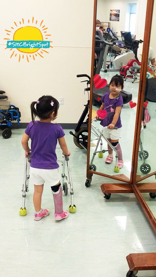 shrinershosp's tweet image. "Look at my new foot! I have toes!" Those were the first words Mika said earlier this month, after being fitted with her very own customized purple prosthesis from @ShrinersHON. ow.ly/qY5650zir7m  #SHCBrightSpot #limblossawareness