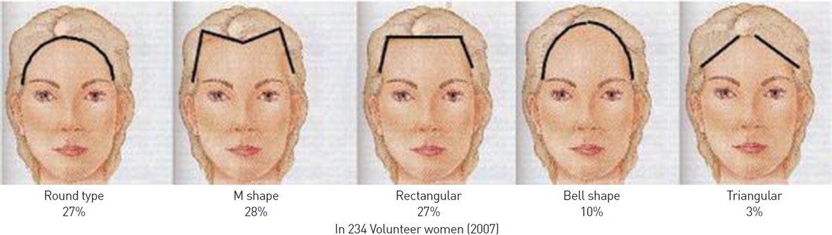 なお Onaco در توییتر 女性のおでこの形 韓国での統計だとおでこの広さ平均6 4cm 横幅14 3cm 丸 ２７ M字 ２８ 長方形 ２７ ベル １０ 丸形だがおでこが2cm広い 三角形 ３ 産毛が多い 富士山型もこれに該当か 女性の場合上記 の５つ