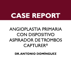 CARDIVAGROUP's tweet photo. Presentamos el Case Report sobre Angioplastia Primaria con Dispositivo Aspirador de Trombos #Capturer, realzado por el Dr. Antonio Dominguez, especialista en Cardiología en el #HospitalUniversitarioVirgendelaVictoria de Málaga.

https://t.co/4JIk8HKwZw

#innovaciónycompromiso https://t.co/ncBe2OZChi