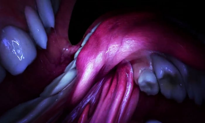 Mouth Mantra (2015)Shot partially in a mock-up of the singer's mouth, also contains parts in which Björk is shown dancing in a white dress. A virtual reality version of the video premiered at the Björk Digital exhibition
