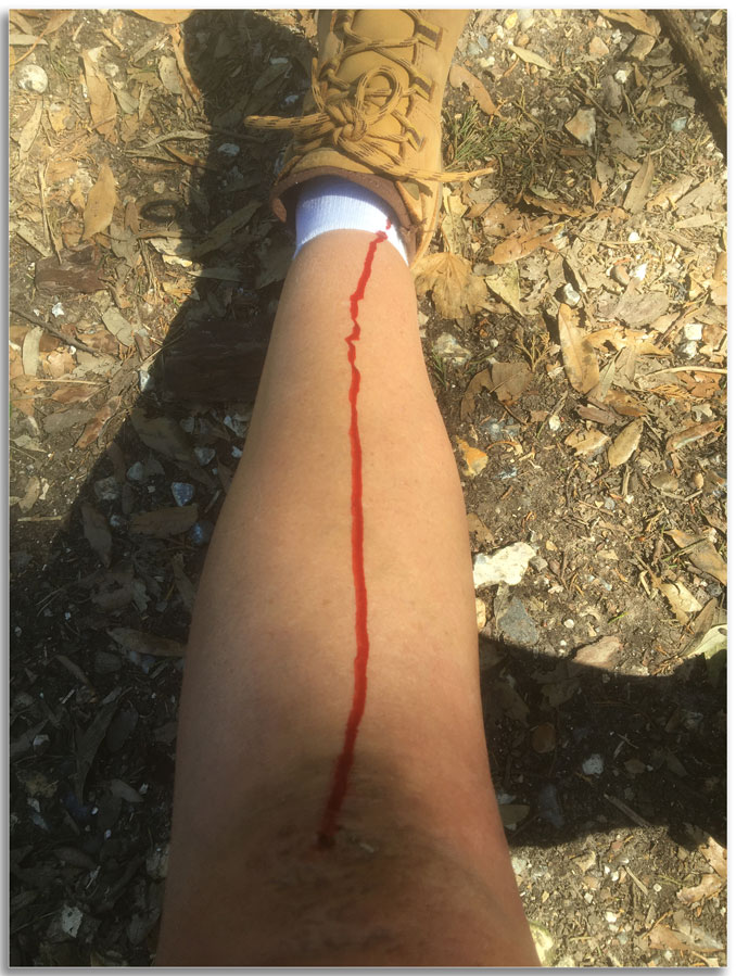 janestokes13's tweet photo. As a child I'd come home & my Mum would say "Oh, you've fallen over", now I am a bit older I come home & get greeted with 'Oh, you've had a fall" Bring back the days when I fell over, it is far preferable.
The lengths photographers will go to to protect their cameras #IFellOver https://t.co/NXlv6afVmk