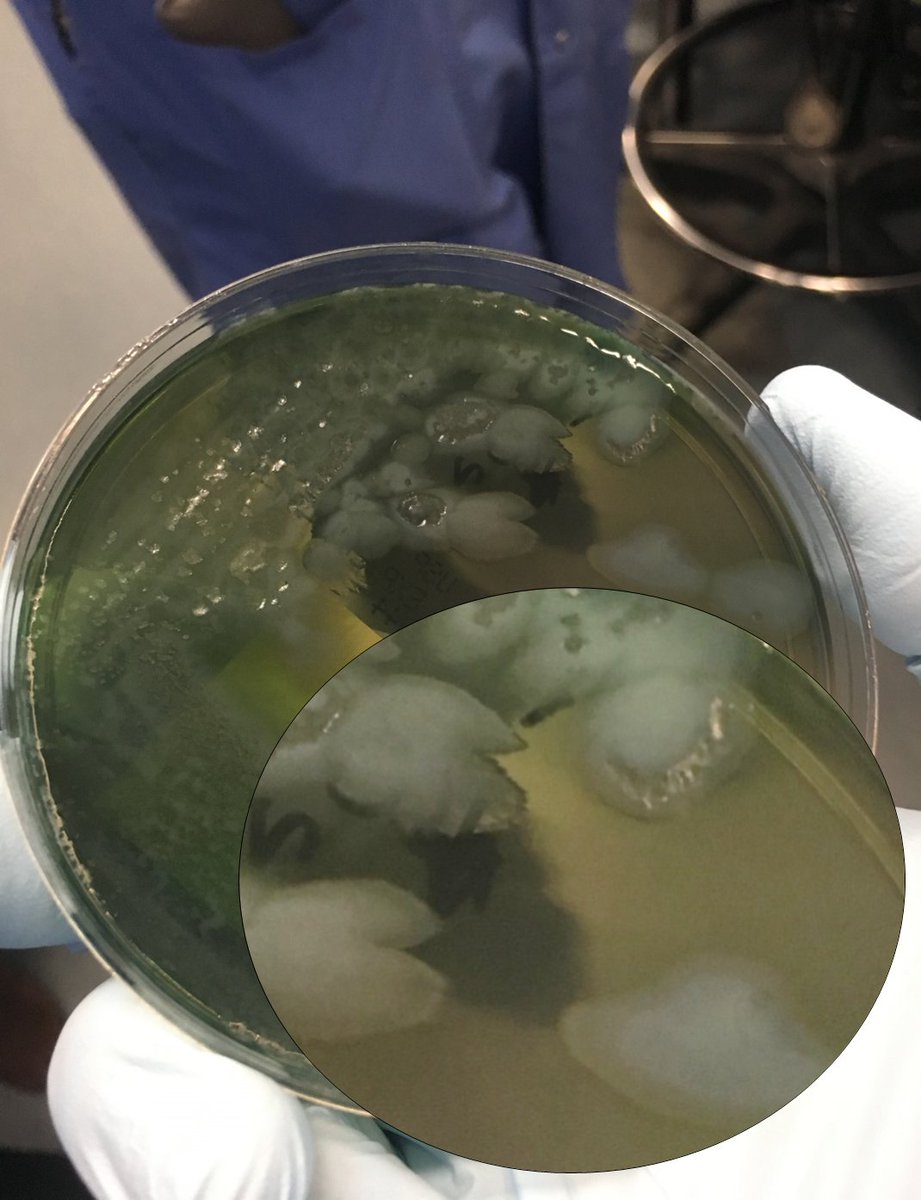 If you're a lab professional, twitter is an amazing place to get a glimpse into the lives, accomplishments and advocacy of people who live with the diseases we help diagnose.  @Potato_Chip is an incredible person who has CF. Here's a green Pseudomonas aeruginosa for her.