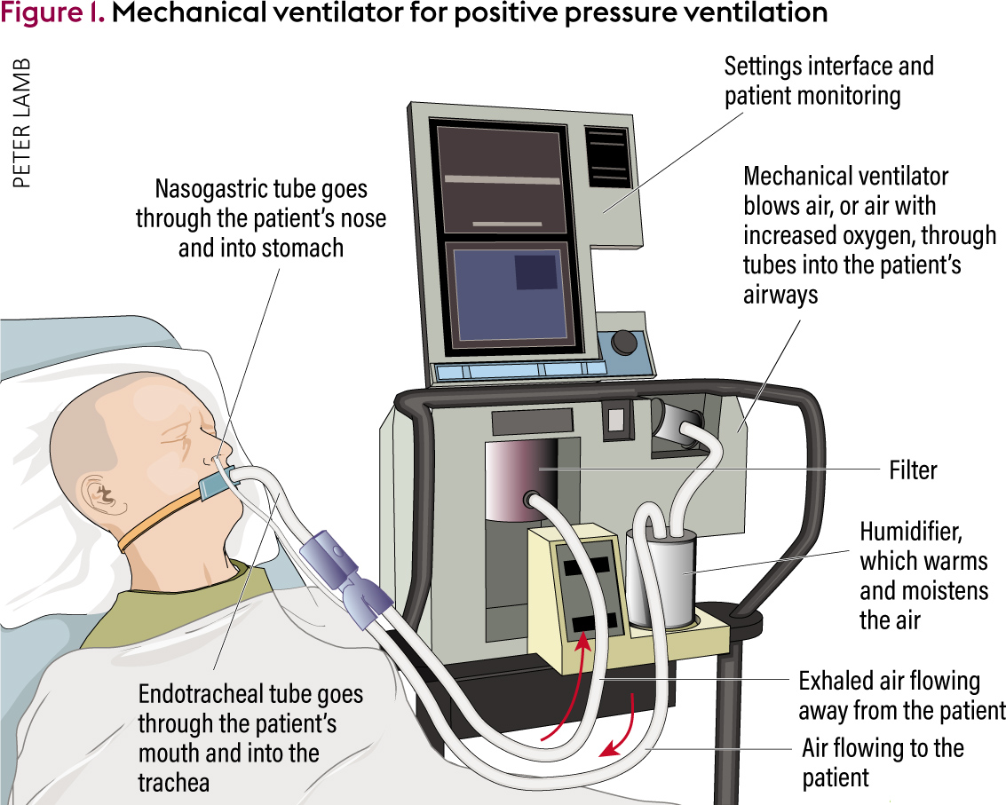 ThreadI can finally give you a hard humber for mechanical ventilators in the US.This should lay to rest the notion that  @realDonaldTrump was either slow to react or overreacted.
