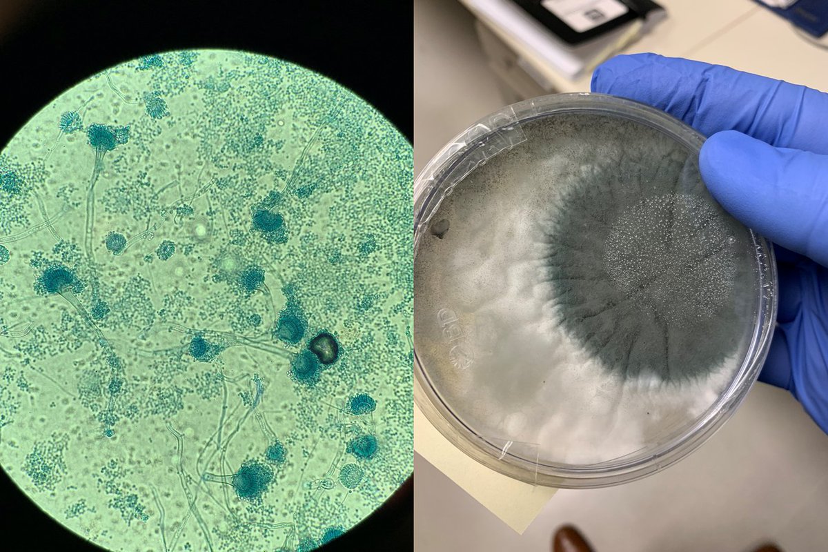 Two more Canadian medical laboratory scientists,  @kab153 and  @madison_sielski who are talking about the crucial role of laboratory professionals.  #LabWeek2020  #MLPW2020Here's mycology classic: Aspergillus fumigatus  https://twitter.com/kab153/status/1252339715212115971?s=20