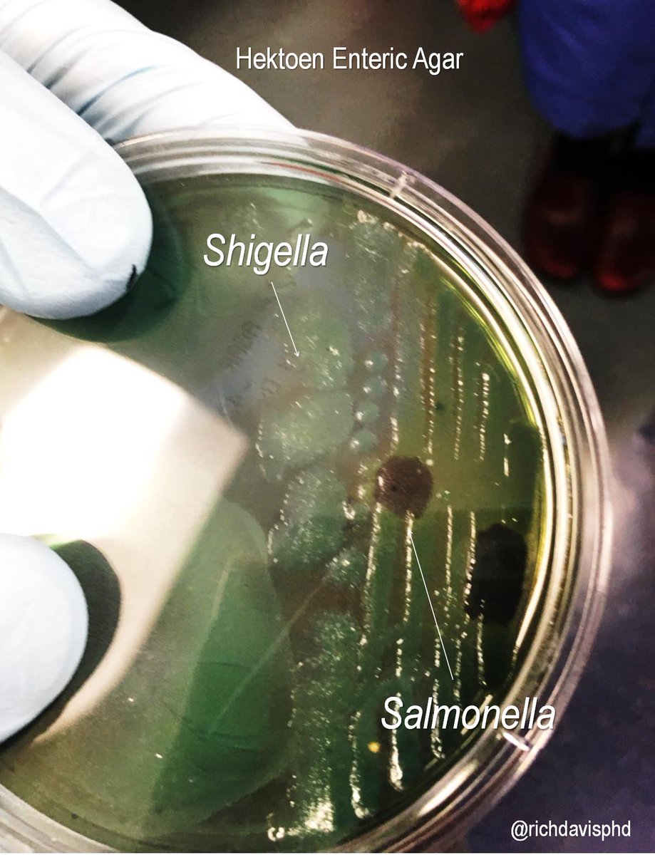 Laboratory medicine is absolutely a collaborative, international community, helped immeasurably by twitter/social media #LabWeek2020  #MLPW2020Here are two of the best known GI bacterial pathogens, growing together: Salmonella (black on HE) & Shigella  https://twitter.com/ialbanez9/status/1252342355752935427?s=20