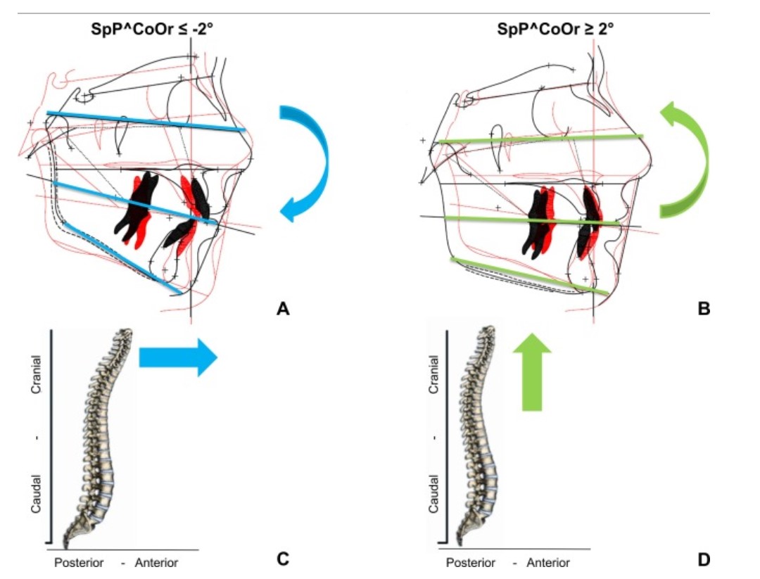 The system goes on overdrive when you clench, and the disturbed signal leads to an improper muscle tone.- Neck tension- Misaligned joints- Poor core controlThis study from the Journal of Electromyography and Kinesiology examined the link between posture and jaw alignment.