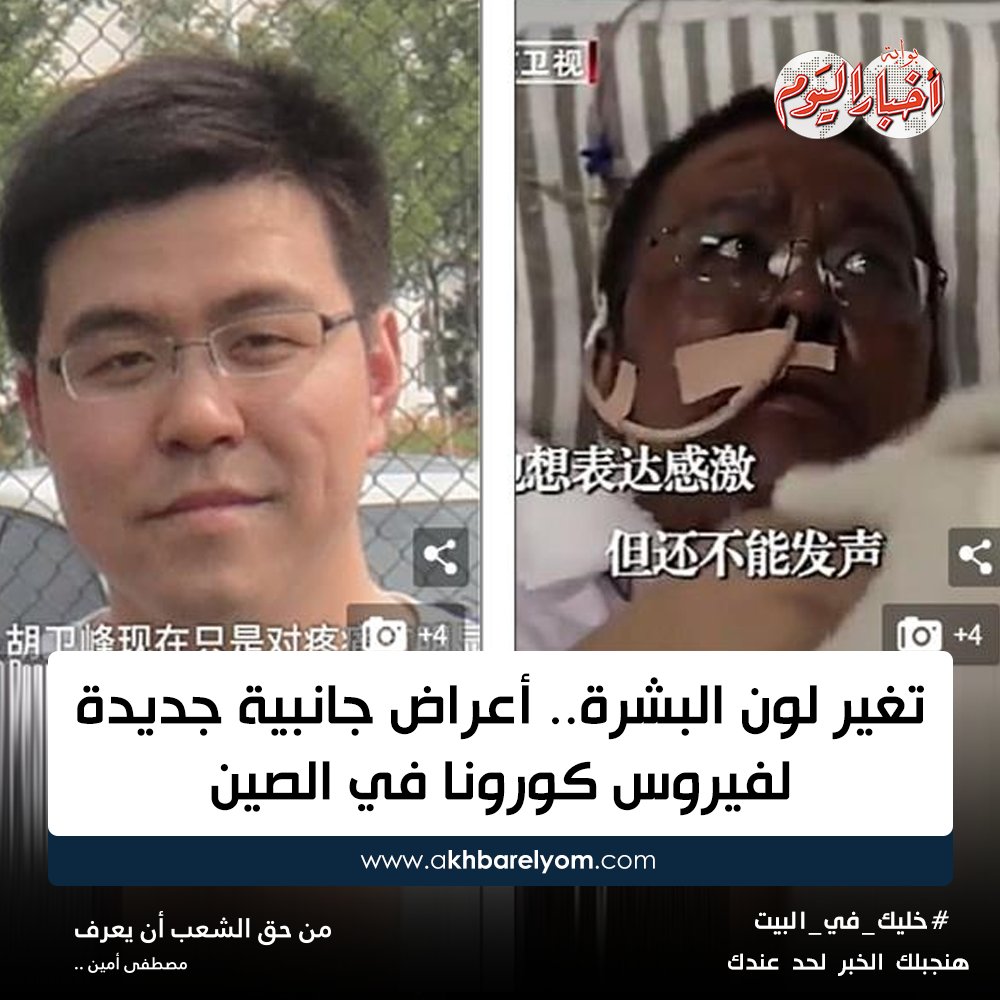 بوابة أخبار اليوم تغير لون البشرة أعراض جانبية جديدة ل فيروس كورونا في الصين