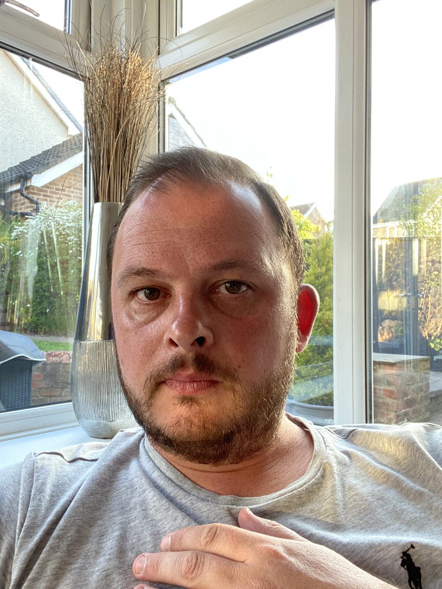 C_Short11's tweet photo. So my hair was getting a bit long for my “usual” style so I combed it over a bit and I have been growing a beard . My other half came downstairs and said “ what have you done to your hair ? their is no reason to start trying to look like @rickygervais “ 🤷🏽‍♂️ https://t.co/o49F9Mp9Ck