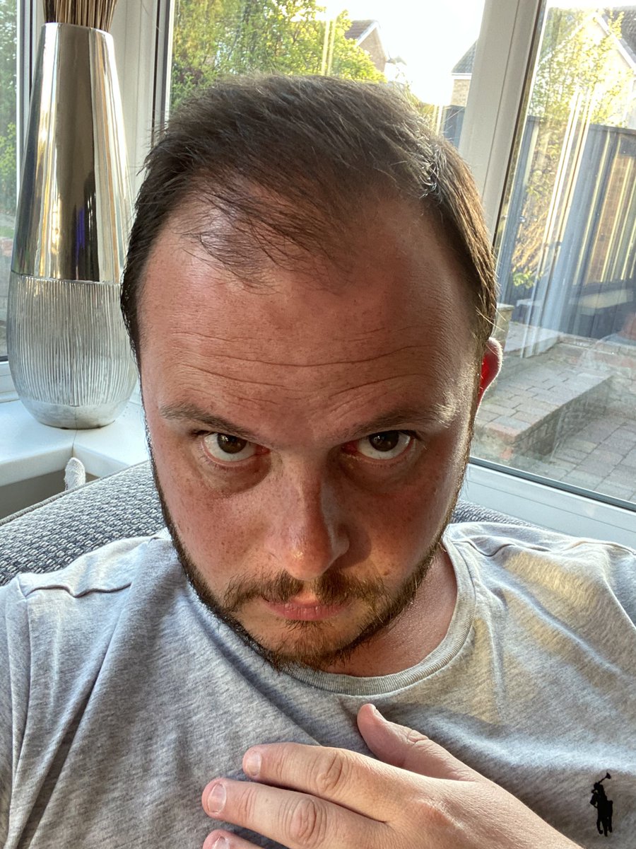 C_Short11's tweet photo. So my hair was getting a bit long for my “usual” style so I combed it over a bit and I have been growing a beard . My other half came downstairs and said “ what have you done to your hair ? their is no reason to start trying to look like @rickygervais “ 🤷🏽‍♂️ https://t.co/o49F9Mp9Ck