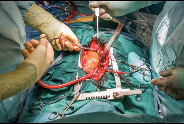 cardiosystemsp's tweet photo. Cirurgia Cardíaca
#cardiosystemsp https://t.co/dbjGO6IXtK
