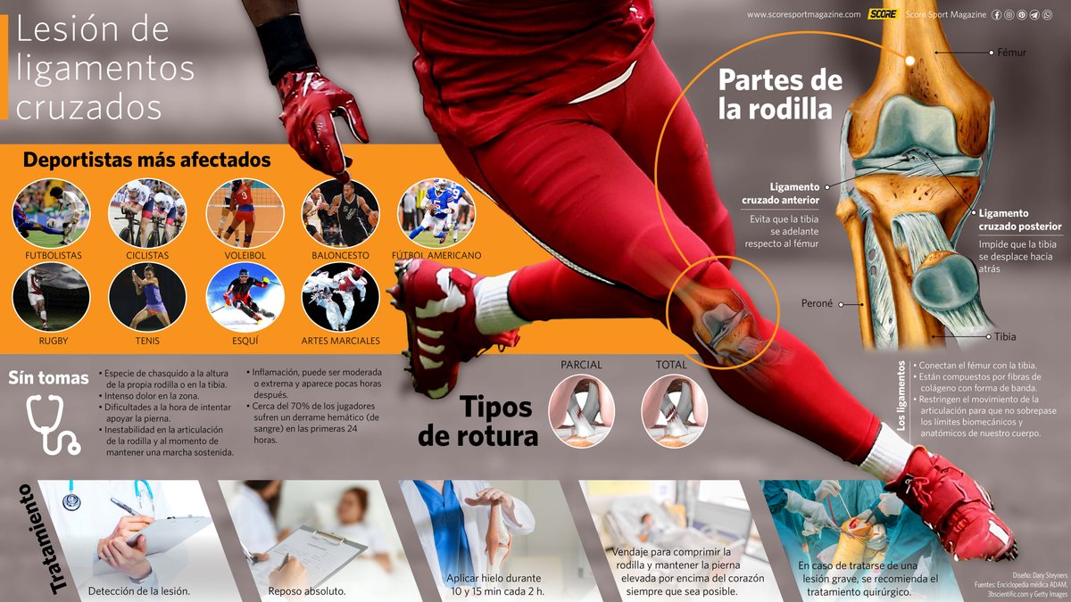 score_spport's tweet photo. Seguro habrás escuchado alguna vez que un deportista sufrió una lesión de ligamentos cruzados🤔⁉️
Pero, ¿qué es esta lesión y cómo se trata? 🤷♀️
Aquí te explicamos 👇
https://t.co/Kld80m1aLZ
#lesion #ligamentoscruzados #atleta #infografia #infographic #ScoreSportMagazine https://t.co/ZOCKJKNSLQ