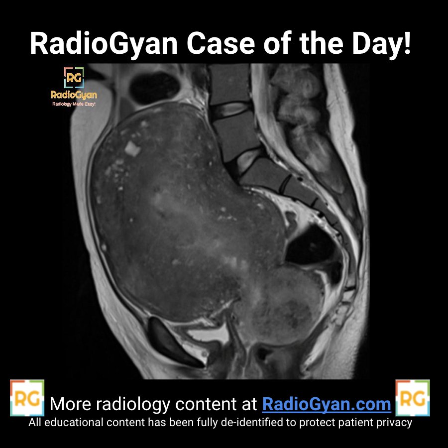RadioGyan's tweet photo. #RGCOD 30
What is your diagnosis for this #GUrad case?
Answer in GIFs only, otherwise, your answers will be hidden.
#FOAMrad #radres #RGcases #radtwitter #medtwitter #radcases https://t.co/J7nRYupvsT