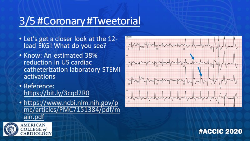 5/10 @yaqoub_lina  @heartdocandcrew  @KhandelwalMD  @BillONeillMD  @onco_cardiology  @MarwanSaadMD  @skilicmd  @DrAdaStefanescu  @PushpaShivaram  @marktuttle  @atunuguntla1 An estimated 38% reduction in US cardiac catheterization laboratory STEMI activations! https://www.ncbi.nlm.nih.gov/pmc/articles/PMC7151384/pdf/main.pdf