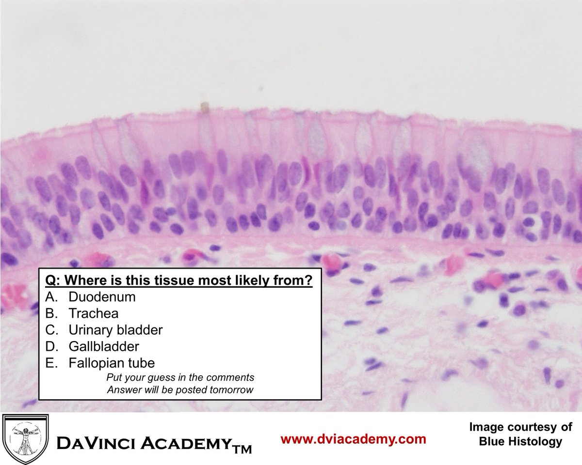 DviAcademy's tweet photo. Where is the tissue in the #histology image below most likely from! Answer will be posted in 24 hours. 

#FOAMed #USMLE #COMLEX #MedEd #medschool  #dentalschool #histo #histologylab #histologyquiz #anatomy #physiology #pathology #Biology #cellbio #medstudent #dentalstudent https://t.co/VT8ZrOLlpP